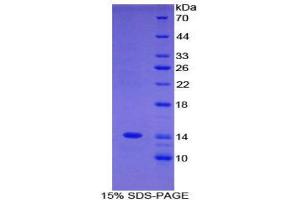 SDS-PAGE (SDS) image for Complement Component 4 Binding Protein, alpha (C4BPA) (AA 358-469) protein (His tag) (ABIN1877933) (C4BPA Protein (AA 358-469) (His tag))