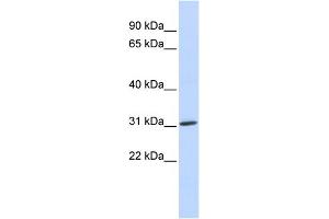 WB Suggested Anti-ARD1A Antibody Titration:  0. (NAA10 抗体  (Middle Region))