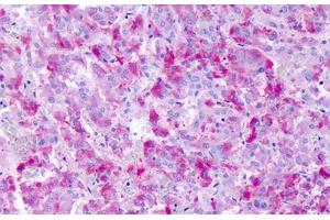 Anti-GPR139 antibody IHC staining of human adrenal medulla. (GPR139 抗体  (Cytoplasmic Domain))