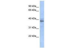 Image no. 1 for anti-Zinc Finger Protein 625 (ZNF625) (AA 67-116) antibody (ABIN6740632) (ZNF625 抗体  (AA 67-116))