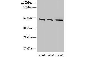 Western blot All lanes: HSDL2 antibody at 3 μg/mL Lane 1: 293T whole cell lysate Lane 2: Hela whole cell lysate Lane 3: HepG2 whole cell lysate Secondary Goat polyclonal to rabbit IgG at 1/10000 dilution Predicted band size: 46, 38 kDa Observed band size: 46 kDa (HSDL2 抗体  (AA 1-345))