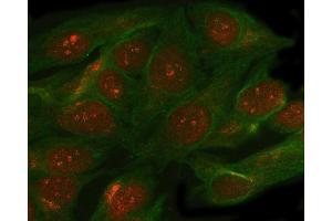 IF analysis of SMC5 using anti-SMC5 antibody (ABIN7600007) and anti-Beta Tubulin antibody (ABIN7602743). (SMC5 抗体  (AA 14-1089))