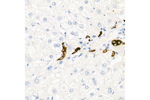 Immunohistochemistry of paraffin-embedded Human liver (negative control sample) using Cytokeratin 19 (KRT19) antibody (ABIN7268099) at dilution of 1:100 (40x lens). (Cytokeratin 19 抗体)