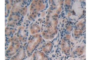 Immunohistochemistry (IHC) image for anti-alpha-Fetoprotein (AFP) (AA 31-171) antibody (ABIN7429538)
