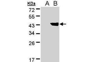 WB Image Western Blot analysis of DHDH expression in transfected 293T cell line by DHDH polyclonal antibody. (AKR1C1 抗体)