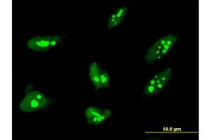 Immunofluorescence of monoclonal antibody to THAP1 on HeLa cell. (THAP1 抗体  (AA 1-213))