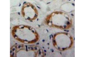Used in DAB staining on fromalin fixed paraffin-embedded Kidney tissue (CD59 抗体  (AA 23-105))