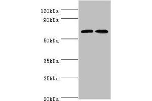 Western blot All lanes: CREB3L2 antibody at 6 μg/mL Lane 1: Mouse liver tissue Lane 2: Mouse lung tissue Secondary Goat polyclonal to rabbit IgG at 1/10000 dilution Predicted band size: 58, 51, 28 kDa Observed band size: 58 kDa (CREB3L2 抗体  (AA 1-247))