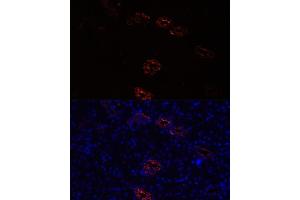 Immunofluorescence analysis of rat kidney cells using  antibody (ABIN7265652) at dilution of 1:100. (AQP2 抗体  (AA 147-271))