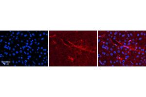 Rabbit Anti-SLC5A5 Antibody  Catalog Number: ARP43751_P050 Formalin Fixed Paraffin Embedded Tissue: Human Adult liver  Observed Staining: Membrane Primary Antibody Concentration: 1:600 Secondary Antibody: Donkey anti-Rabbit-Cy2/3 Secondary Antibody Concentration: 1:200 Magnification: 20X Exposure Time: 0. (SLC5A5 抗体  (N-Term))
