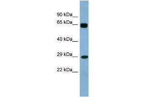 WB Suggested Anti-LRRN4CL Antibody Titration: 0. (LRRN4CL 抗体  (Middle Region))