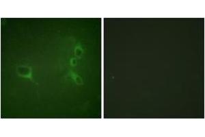 Immunofluorescence analysis of NIH-3T3 cells, using Bcr (Phospho-Tyr360) Antibody. (BCR 抗体  (pTyr360))