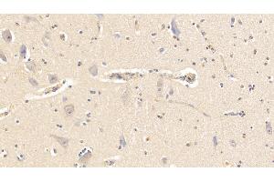 Detection of AHSG in Bovine Cerebellum Tissue using Polyclonal Antibody to Alpha-2-Heremans Schmid Glycoprotein (AHSG) (Fetuin A 抗体  (AA 19-359))