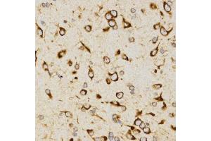 Immunohistochemistry of paraffin-embedded rat brain using LAMP3 antibody (ABIN5971497) at dilution of 1/200 (40x lens). (LAMP3 抗体)