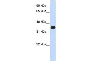 WB Suggested Anti-C2orf47 Antibody Titration:  0. (C2orf47 抗体  (Middle Region))