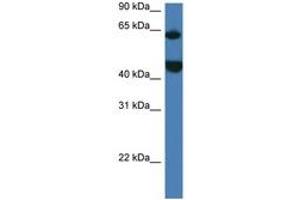 Image no. 1 for anti-Lysophosphatidylcholine Acyltransferase 2 (LPCAT2) (AA 167-216) antibody (ABIN6747272) (LPCAT2 抗体  (AA 167-216))