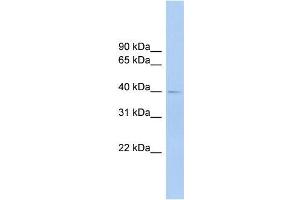 Human Lung; WB Suggested Anti-FCRLA Antibody Titration: 0. (FCRLA 抗体  (C-Term, Isoform 9, Middle Region))