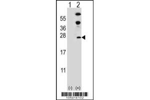 Western blot analysis of DUSP14 using rabbit polyclonal DUSP14 Antibody (D183) using 293 cell lysates (2 ug/lane) either nontransfected (Lane 1) or transiently transfected (Lane 2) with the DUSP14 gene. (DUSP14 抗体  (C-Term))