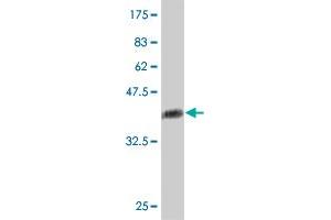 Western Blot detection against Immunogen (38.