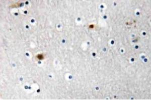 Immunohistochemistry (IHC) analyzes of TAF I p48 antibody in paraffin-embedded human brain carcinoma tissue. (SET/TAF-I 抗体)