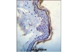 Immunohistochemistry (Paraffin-embedded Sections) (IHC (p)) image for anti-Mast/stem Cell Growth Factor Receptor (KIT) (AA 106-135), (N-Term) antibody (ABIN392010)