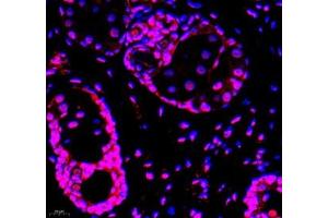 Immunofluorescence (Paraffin-embedded Sections) (IF (p)) image for anti-General Transcription Factor IIIC, Polypeptide 3, 102kDa (GTF3C3) antibody (ABIN7074039)