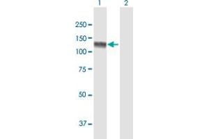 Western Blot analysis of USP20 expression in transfected 293T cell line by USP20 MaxPab polyclonal antibody. (USP20 抗体  (AA 1-913))
