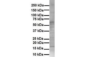 WB Suggested Anti-KRT16 antibody Titration: 1 ug/mL Sample Type: Human HepG2 (KRT16 抗体  (Middle Region))