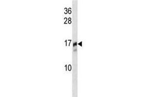 TRAPPC2 antibody western blot analysis in NCI-H292 lysate. (TRAPPC2 抗体  (AA 11-39))