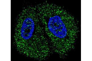 Fluorescent confocal image of MCF7 cells stained with Pyruvate Kinase (PKM2) antibody. (Pyruvate Kinase 抗体  (C-Term))