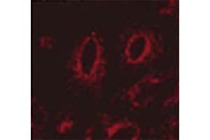 Immunocytochemistry/Immunofluorescence analysis using Mouse Anti-LAMP1 Monoclonal Antibody, Clone Ly1C6 . (LAMP1 抗体  (HRP))