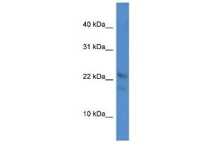 WB Suggested Anti-Omp Antibody Titration: 1.
