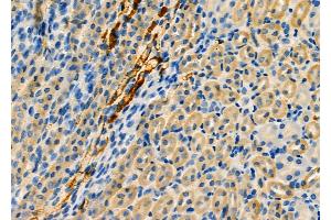 ABIN6259341 and ABIN6275460 at 1/100 staining Mouse kidney tissue by IHC-P. (RAB20 抗体  (Internal Region))