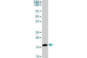 NME2 monoclonal antibody (M06), clone 1D3. (NME2 抗体  (AA 51-152))