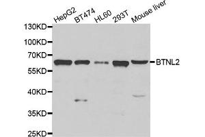 Western blot analysis of extracts of various cell lines, using BTNL2 antibody. (BTNL2 抗体)