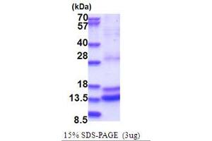 Caspase 2 Protein (AA 348-452) (His tag)