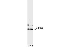 Western Blotting (WB) image for anti-Achaete-Scute Complex Homolog 1 (Drosophila) (ASCL1) antibody (ABIN967560) (ASCL1 抗体)