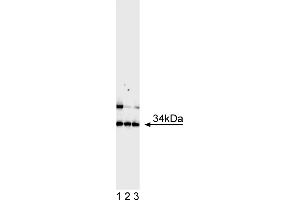 Western Blotting (WB) image for anti-Achaete-Scute Complex Homolog 1 (Drosophila) (ASCL1) antibody (ABIN967560)