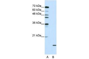 SNRPA1 antibody used at 2. (SNRPA1 抗体  (C-Term))