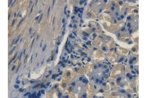 DAB staining on IHC-P; Samples: Mouse Stomach Tissue (TRAPPC10 抗体  (AA 1077-1259))