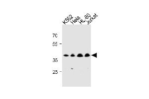 MECR Antibody (Center) (ABIN1881536 and ABIN2843275) western blot analysis in K562,Hela,HL-60,Jurkat cell line lysates (35 μg/lane). (MECR 抗体  (AA 201-229))