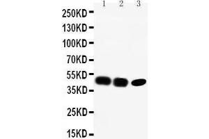 Anti-CCR6 antibody, Western blotting Lane 1: Rat Liver Tissue Lysate Lane 2: SW620 Cell Lysate Lane 3: CEM Cell Lysate (CCR6 抗体  (C-Term))
