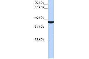 WB Suggested Anti-TP53I13 Antibody Titration:  0. (TP53I13 抗体  (C-Term))
