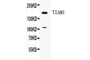 Western blot analysis of TIAM1 expression in MCF-7 whole cell lysates ( Lane 1).