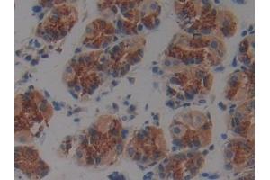 DAB staining on IHC-P; Samples: Human Stomach Tissue (Plakophilin 2 抗体  (AA 571-849))