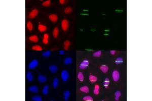 Immunofluorescence analysis of U2OS cells using POLE3 antibody (ABIN5973867). (POLE3 抗体)