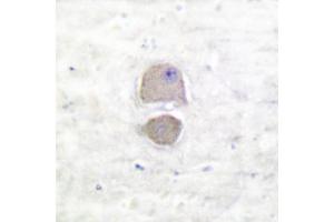 Image no. 1 for anti-BCL2-Associated X Protein (BAX) antibody (ABIN265325) (BAX 抗体)
