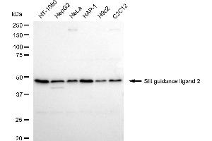 anti-Slit Homolog 2 (Drosophila) (SLIT2) antibody