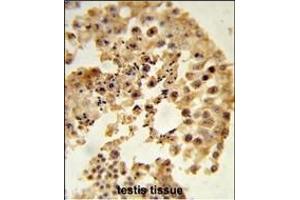 Formalin-fixed and paraffin-embedded human testis tissue reacted with D Antibody (N-term), which was peroxidase-conjugated to the secondary antibody, followed by DAB staining. (DPP8 抗体  (N-Term))