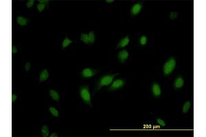 Immunofluorescence of monoclonal antibody to RNMT on HeLa cell. (RNMT 抗体  (AA 1-476))